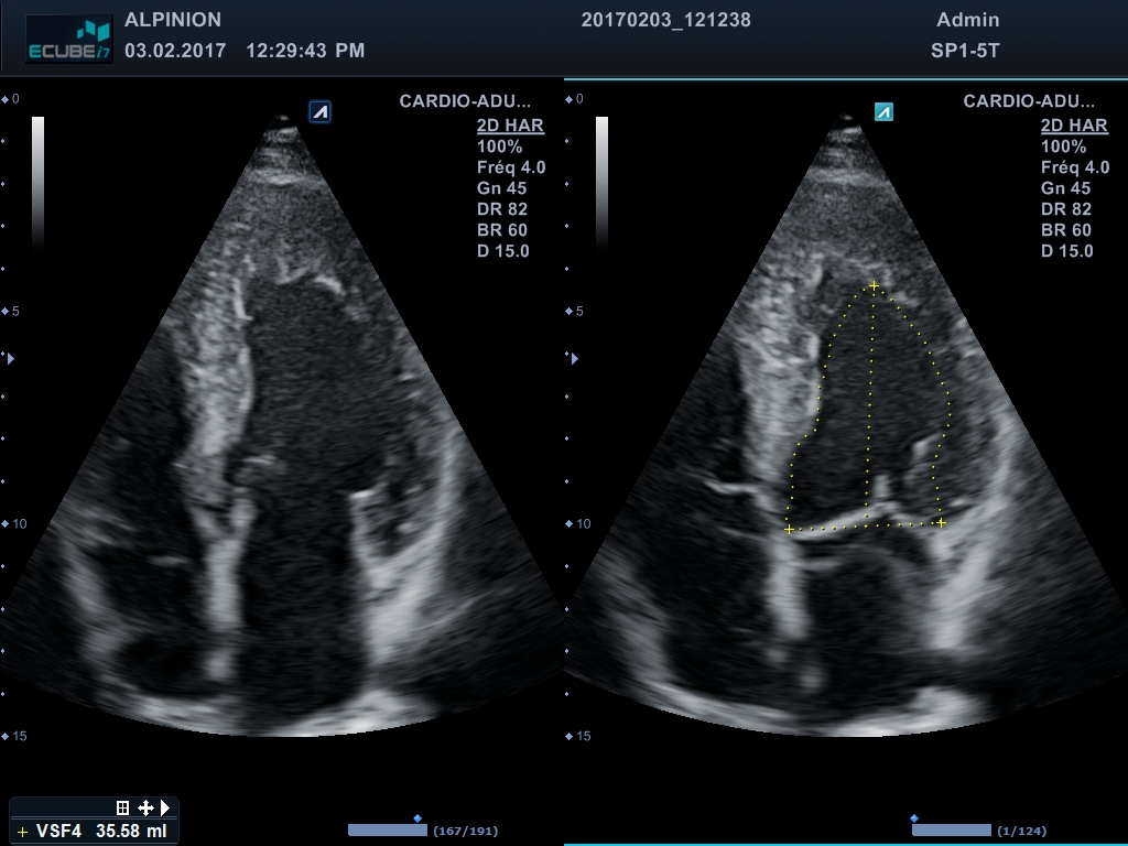 Logiciel Cardiologie